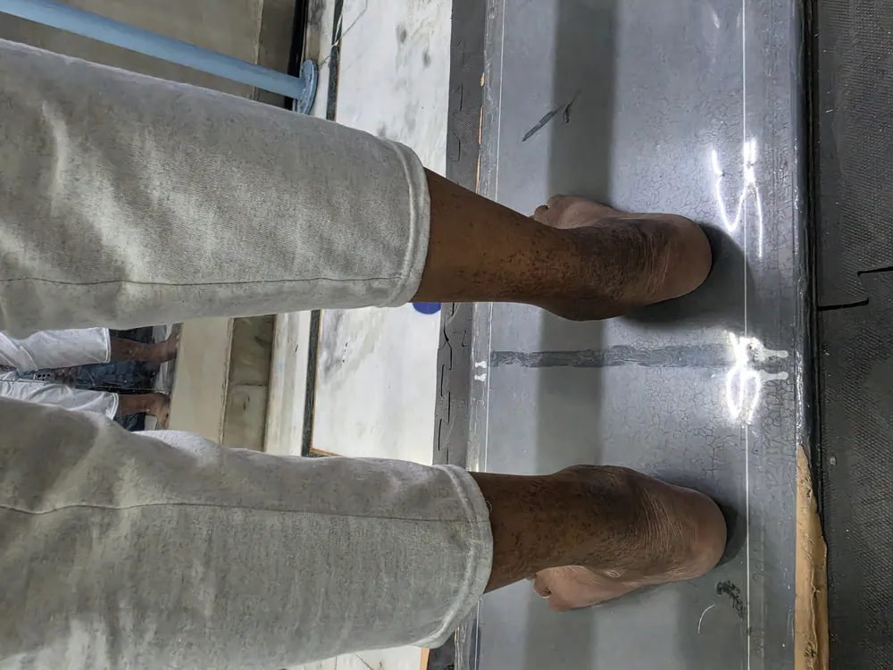 Footscan platform assessment at P.O.R.C