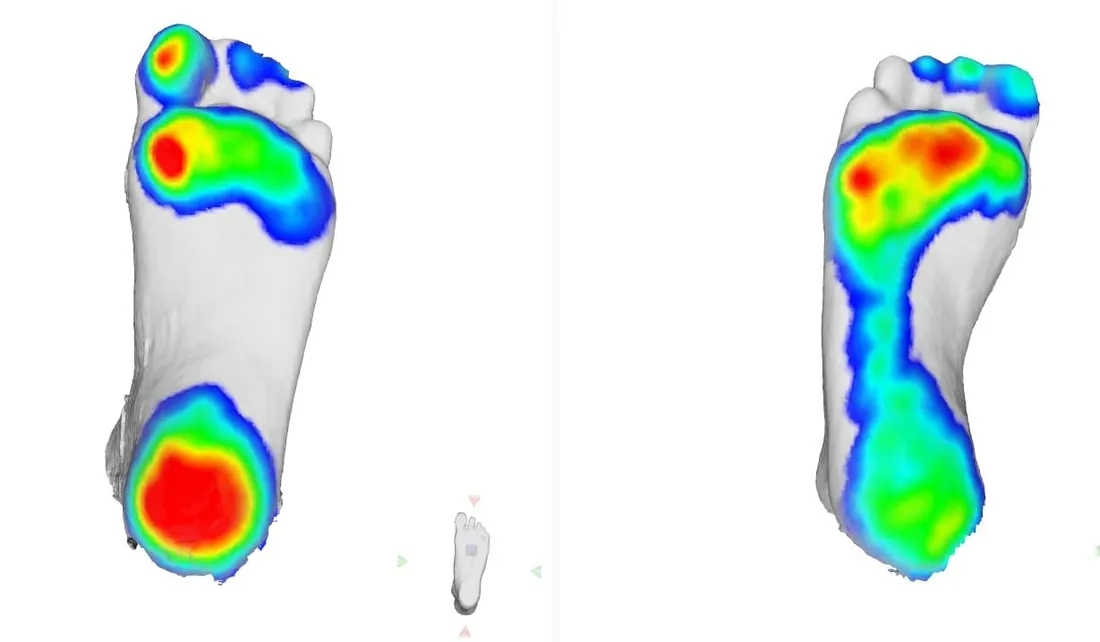 Footscan pressure map on screen