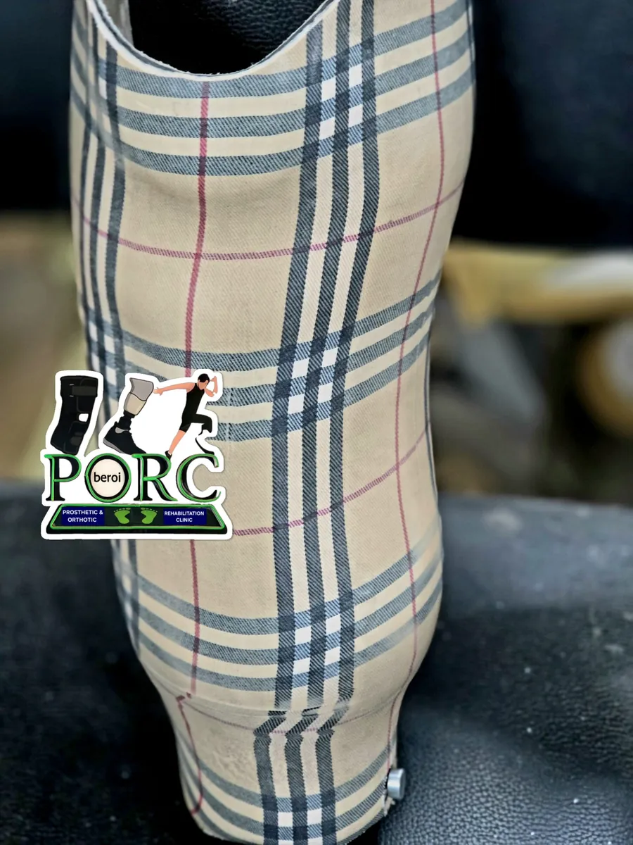 Laminated prosthetic socket made at P.O.R.C